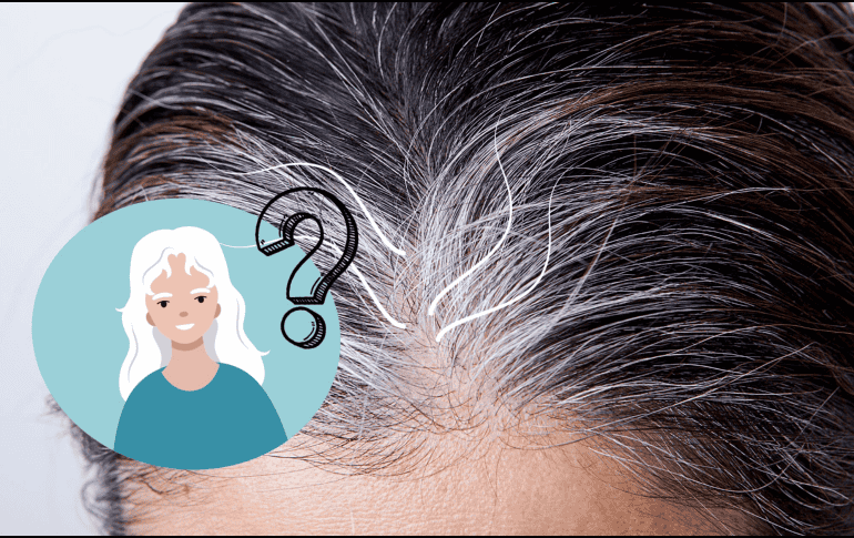 Si bien la aparición de canas está mayormente determinada por la genética, una deficiencia de vitamina B12 podría acelerar este proceso. CANVA