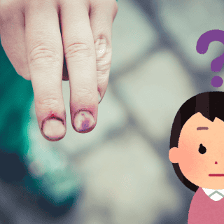 ¿Por qué aparecen moretones en la piel?