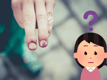 Si notas moretones sin un golpe evidente, es importante no ignorarlos. Podrían ser indicativos de un problema de salud más grave. UNSPLASH / M. Spiske