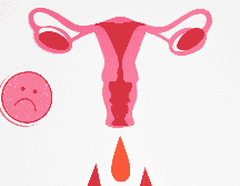 La endometriosis puede confundirse con otras afecciones, como quistes ováricos, enfermedad inflamatoria pélvica o síndrome del intestino irritable. CANVA / N. Moryak
