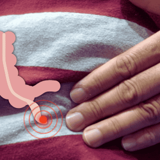 Así DUELE cuando hay apendicitis