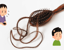 Identifica el tipo de alopecia que tienes. ESPECIAL / Pixabay @pimnana