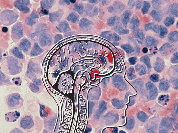Un diagnóstico temprano podría permitir intervenciones más efectivas para evitar el deterioro neurológico. UNSPLASH / National Cancer Institute