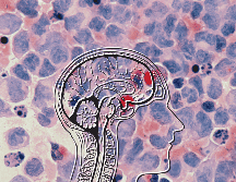 Un diagnóstico temprano podría permitir intervenciones más efectivas para evitar el deterioro neurológico. UNSPLASH / National Cancer Institute