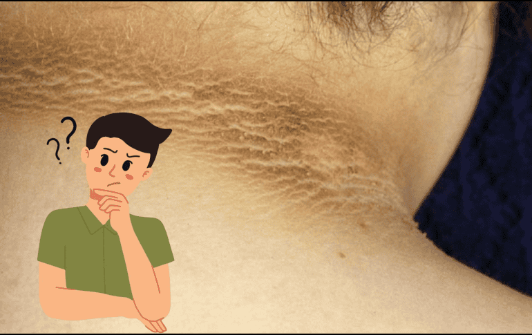 El oscurecimiento del cuello no siempre se debe a falta de higiene, sino que puede ser un síntoma de una condición subyacente. CANVA