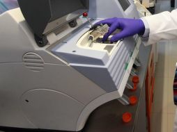 Revisiones periódicas y hábitos saludables ayudan a mitigar uno de los cánceres más frecuentes en México. NTX / ARCHIVO