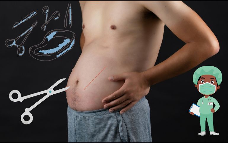 La edad principal en la que los hombres se someten a cirugías estéticas es a los 40 años, que es la edad promedio de la aparición de los primeros signos de envejecimiento. ESPECIAL / UNSPLASH / S. SEAN / CANVA