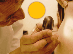 El carcinoma basocelular es un cáncer de los más 