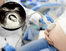 El desarrollo fetal es un proceso ordenado y preciso, donde cada sistema y parte del cuerpo crece en un momento específico para asegurar la formación adecuada del ser humano. 
 CANVA