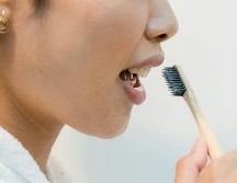 El sarro es consecuencia del endurecimiento de la placa bacteriana. Pexels