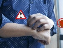 Si tienes chinches en casa, lo más recomendable para su exterminio es acudir con profesionales. Pexels y Canva