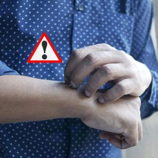 ¡Cuidado! Estos son los riesgos de las chinches para la salud