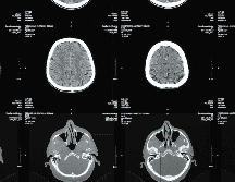 Investigaciones recientes señalan que el entrenamiento de fuerza no solo fortalece los músculos, sino que también beneficia la salud cerebral. Canva / O. Fedorchuk