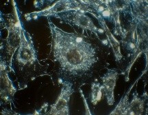 Actualmente, las decisiones sobre tratamiento tras cirugía se basan en criterios anatomo-patológicos. UNSPLASH / Cancer Institute en Unsplash