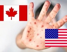 En Estados Unidos se han registrado 800 casos de sarampión durante 2025. ESPECIAL / SUN