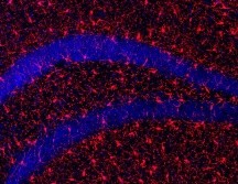 Con la edad, es natural que los seres humanos pierdan masa muscular y ósea, lo que conlleva un aumento de la debilidad, que puede derivar en caídas y lesiones importantes. EFE / ARCHIVO
