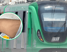 La imagen que muestra una pequeña marca roja en el brazo del joven, presuntamente provocada por el pinchazo. FACEBOOK / Valeria Macías / https://www.metrorrey.mx/