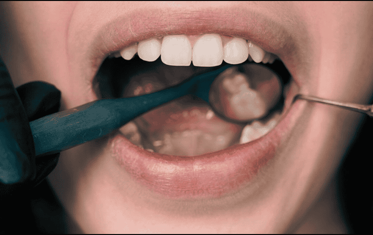 Ante problemas de salud bucal, lo mejor es asistir con un dentista. ESPECIAL / CANVA
