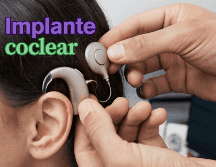 La colocación de este dispositivo es un procedimiento seguro, con una tasa baja de complicaciones intra y postoperatorias. ESPECIAL / CANVA