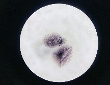 El hallazgo también replantea la necesidad de conocer con más detalle la población de bacterias que pueden colonizar el útero. UNSPLASH / C. Qi Huang