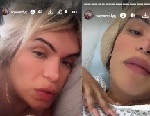 Su historia también deja un mensaje claro: cuidarnos mutuamente, brindar apoyo y evitar la burla ante el sufrimiento ajeno. INSTAGRAM/@wendyguevaraoficial