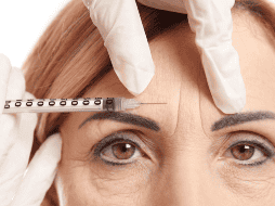 En temas de estética, menos puede ser más, y la clave está en lograr un rostro descansado, fresco y natural, no congelado.CANVA