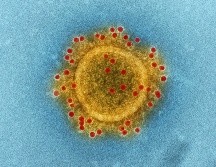 Por ejemplo, la hipótesis de que el virus de la COVID-19 se originara por una fuga en un laboratorio continúa sin poder ser descartada. UNSPLASH / CDC