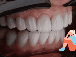 Descubre cómo el bruxismo puede afectar en la salud. UNPLASH / K. HOSEINIANZADE