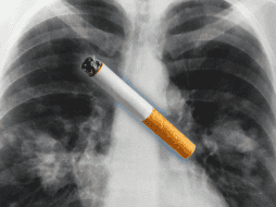 El análisis se basó en 871 muestras de tumores de pulmón de personas no fumadoras residentes en 28 regiones del mundo —incluyendo África, Asia, Europa y América del Norte— con diferentes niveles de contaminación del aire. ESPECIAL / Canva