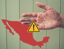 La mayoría de los contagios del brote de sarampión en México, se han presentado en Chihuahua. ESPECIAL / CANVA