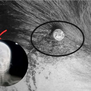 Viral: Insertan clavo en cráneo de mujer embarazada para que dé a luz un varón (VIDEO)