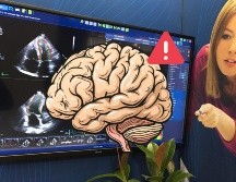 Estas serían las razones por las que se han estado presentando infartos cerebrales en pacientes cada vez más jóvenes. NTX / ARCHIVO