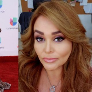 Sheyla donó su piel sobrante a niños quemados luego de perder 58 kilos
