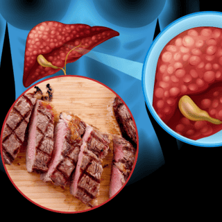 Estos son los alimentos que NO deberías comer si tienes hígado graso