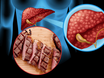 Para tratar el hígado graso, expertos de la UNAM recomiendan llevar una alimentación balanceada, acompañada por actividad física diaria. ESPECIAL