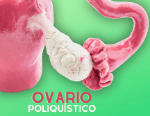 Dentro de los elementos centrales para el desarrollo de ovario poliquístico está la resistencia a la insulina. ESPECIAL / CANVA