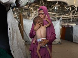 Las muertes por hambre se han disparado en las últimas semanas en Gaza. EFE/ A. AWAD