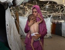 Las muertes por hambre se han disparado en las últimas semanas en Gaza. EFE/ A. AWAD