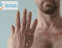 La mayoría de los casos se concentran en la metrópoli, en Puerto Vallarta y Ciudad Guzmán, dijo el titular de la SSJ. CANVA / SUN / ARCHIVO