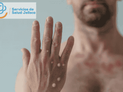 La mayoría de los casos se concentran en la metrópoli, en Puerto Vallarta y Ciudad Guzmán, dijo el titular de la SSJ. CANVA / SUN / ARCHIVO