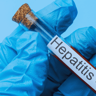 ¿Qué es la hepatitis y cuáles son sus síntomas?