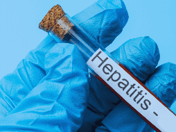 La hepatitis se clasifica en cuatro diferentes tipos, tanto por sus consecuencias, algunas más graves que otras y la forma en que una persona se contagia. ESPECIAL / Canva