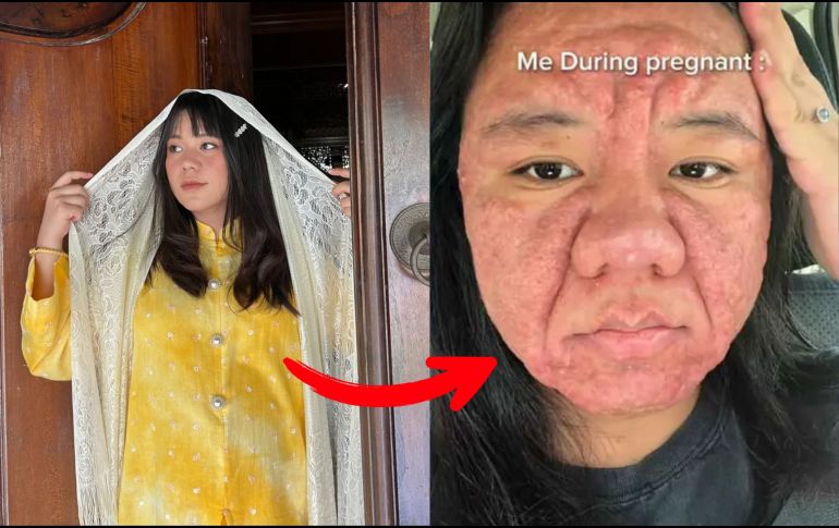 Este caso no solo ha captado la atención por lo llamativo de las imágenes, sino que también ha puesto sobre la mesa una conversación poco abordada sobre las realidades menos visibles del embarazo. INSTAGRAM/@farahf4izal