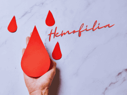 Aunque la hemofilia se presenta mayormente en los hombres, no tiene predilección por ningún grupo social. ESPECIAL / CANVA