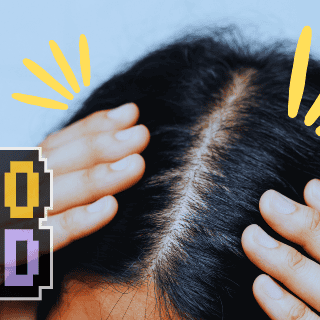 Descubren molécula para combatir la calvicie