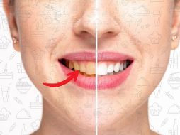 Cuidar tu alimentación y seguir hábitos de higiene bucal adecuados no solo protege tu salud oral, sino que también ayuda a mantener una sonrisa más blanca por más tiempo. CANVA