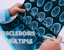 La esclerosis múltiple se asocia a factores ambientales como: exposición a agentes infecciosos, tabaquismo, falta de vitamina D, obesidad, entre otros. ESPECIAL / CANVA