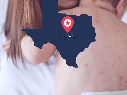 Pese a que el foco de la enfermedad se dio por concluido, las autoridades instaron a mantener las precauciones. ESPECIAL / CANVA