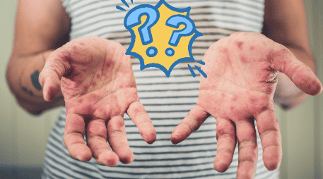 Entidades federativas han implementado medidas de seguimiento y tratamiento para controlar su propagación. CANVA / ESPECIAL