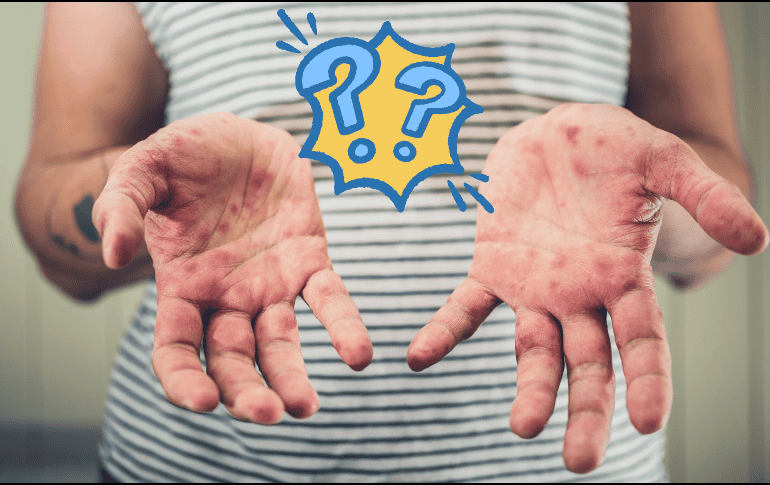 Entidades federativas han implementado medidas de seguimiento y tratamiento para controlar su propagación. CANVA / ESPECIAL